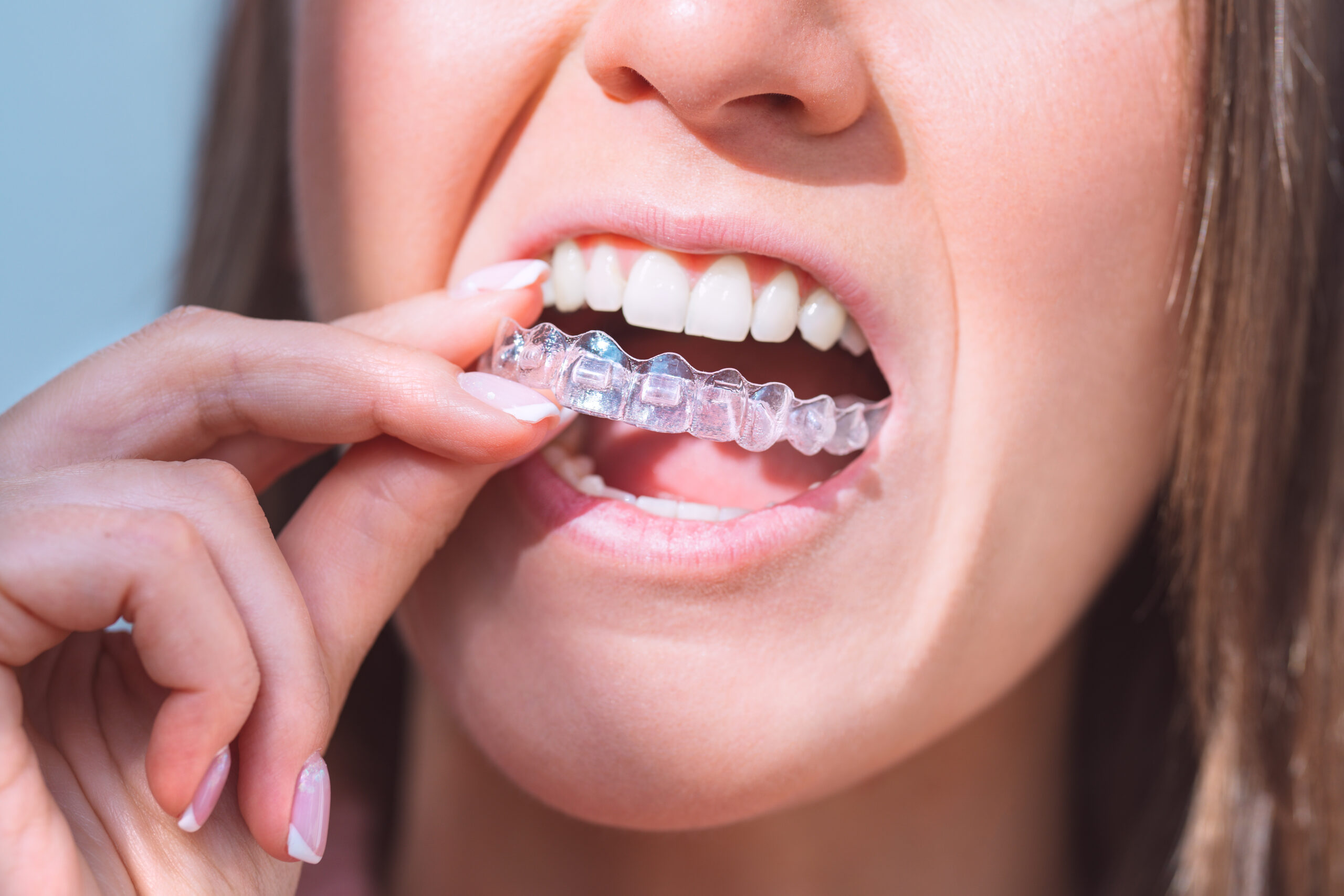 インビザライン治療で歯を削る理由とは？メリットや痛みについて解説