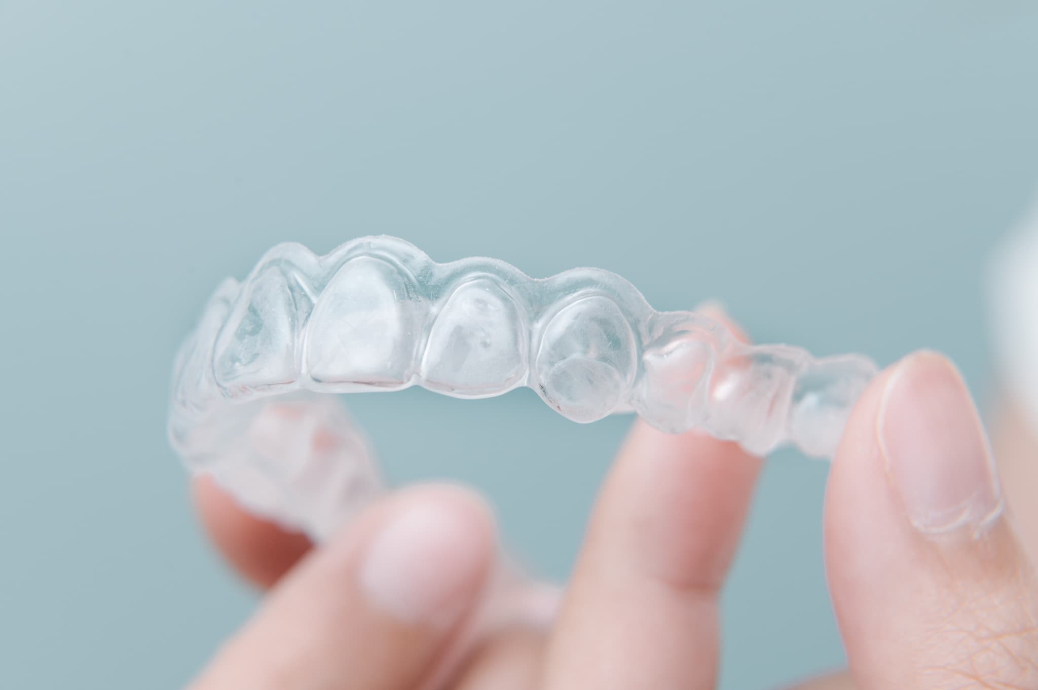 すきっ歯の治療に使用するマウスピース