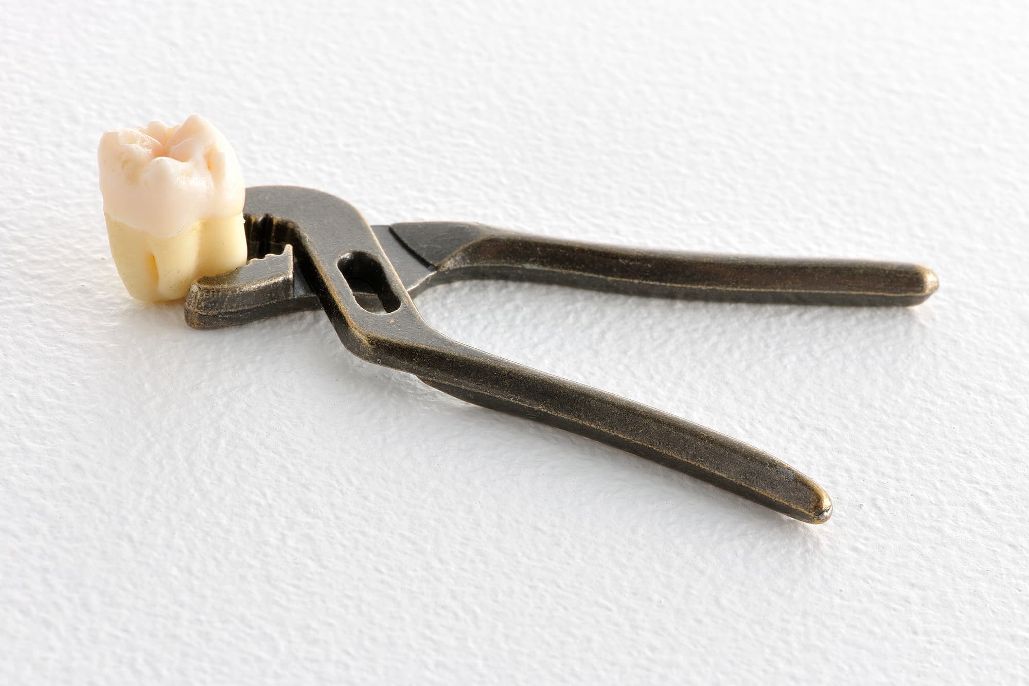 抜歯した親知らず