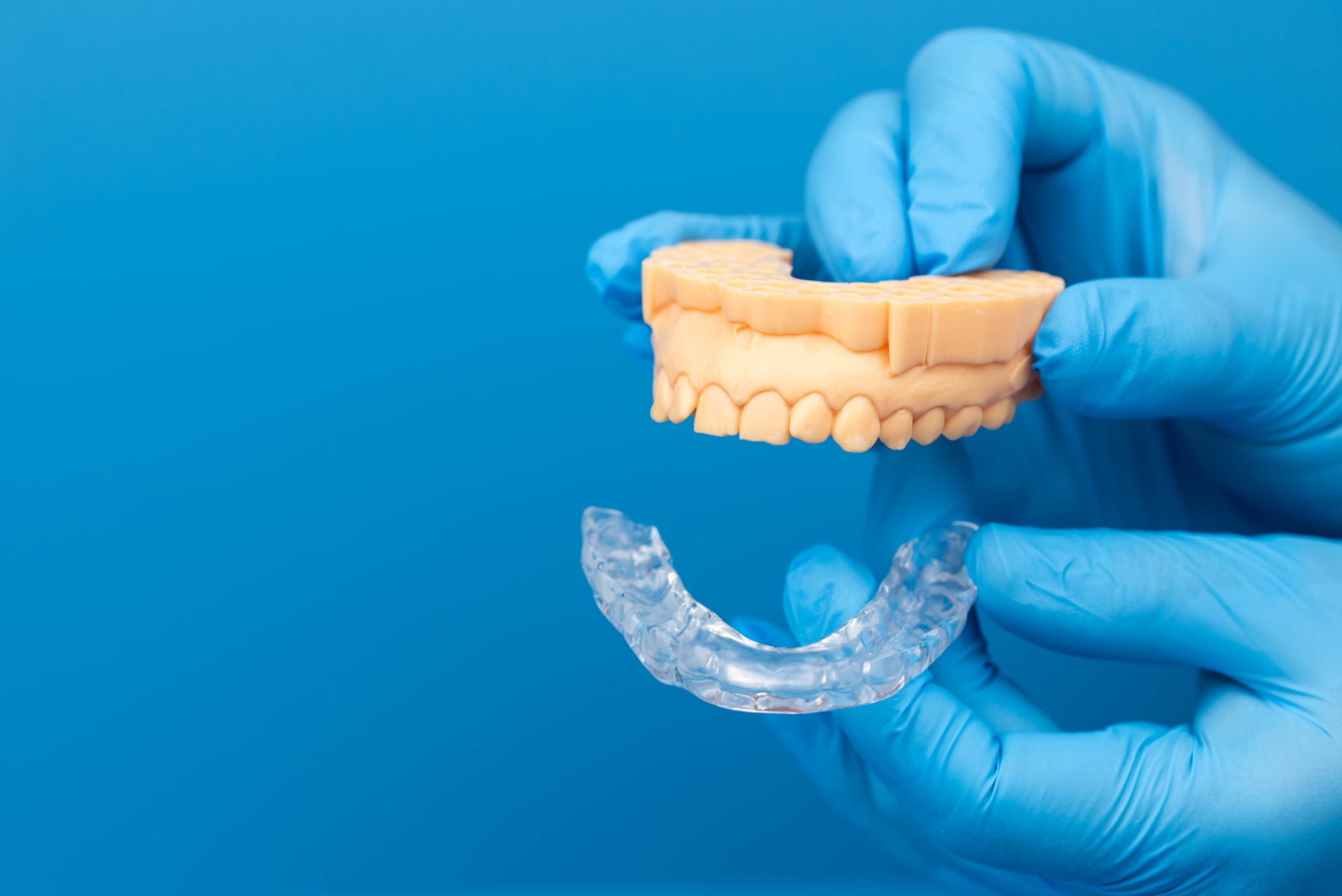 歯の模型とマウスピースを使ってスプリント療法について説明する歯科医